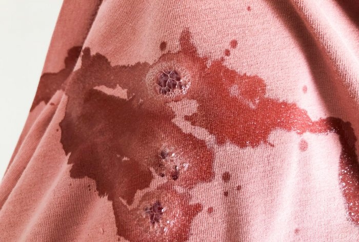 كيفية إزالة الدم من الملابس