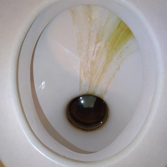 Sådan rengør du et toilet fra rust og plak med dine egne hænder